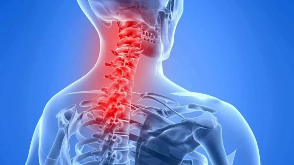 دیسک گردن و علائم آن | فتق دیسک گردن چیست؟