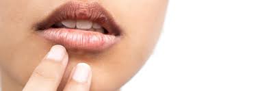 خشکی دهان و روش های درمان آن | خشکی دهان علائم چه بیماری است؟