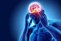 “سردرد وضعیتی یا ارتواستاتیک: علائم، علت‌ها و راهکارهای پیشگیری”