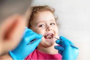 مراقبت پس از درمان با فلوراید در دندانپزشکی