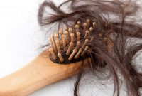 راهکارهای موثر برای مقابله با ریزش موی شدید