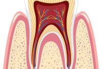 راهنمای جامع در مورد جراحی دندان عقل