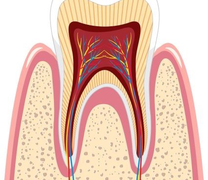 راهنمای جامع در مورد جراحی دندان عقل