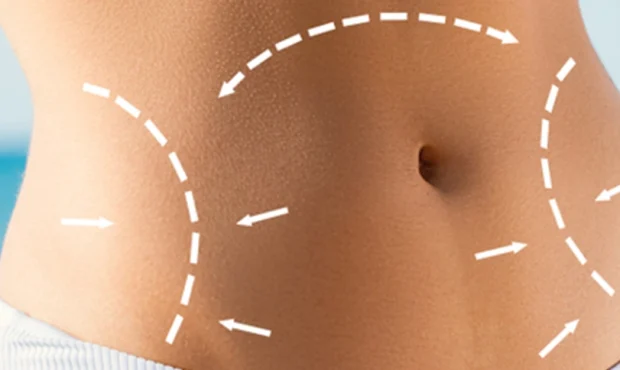 آمادگی قبل از جراحی زیبایی شکم: نکات حیاتی که باید بدانید