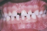 راهکارهای مقابله با ناهنجاری‌های دندانی: علت‌ها، تشخیص و درمان