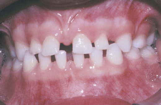 راهکارهای مقابله با ناهنجاری‌های دندانی: علت‌ها، تشخیص و درمان