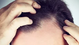 علائم رشد موی جدید: چگونه شناسایی کنیم؟