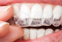 آشنایی با فرایند و محصولات دندان‌پزشکی: اسیداچ، کامپوزیت و سایر محصولات