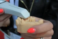 مراقبت‌های لازم برای حفظ ایمپلنت دندان